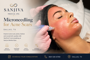 SkinPen microneedling treatment for acne scars at Sanjiva Medical Spa in Dallas, TX